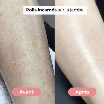 Rasoir Douceur - Tenava