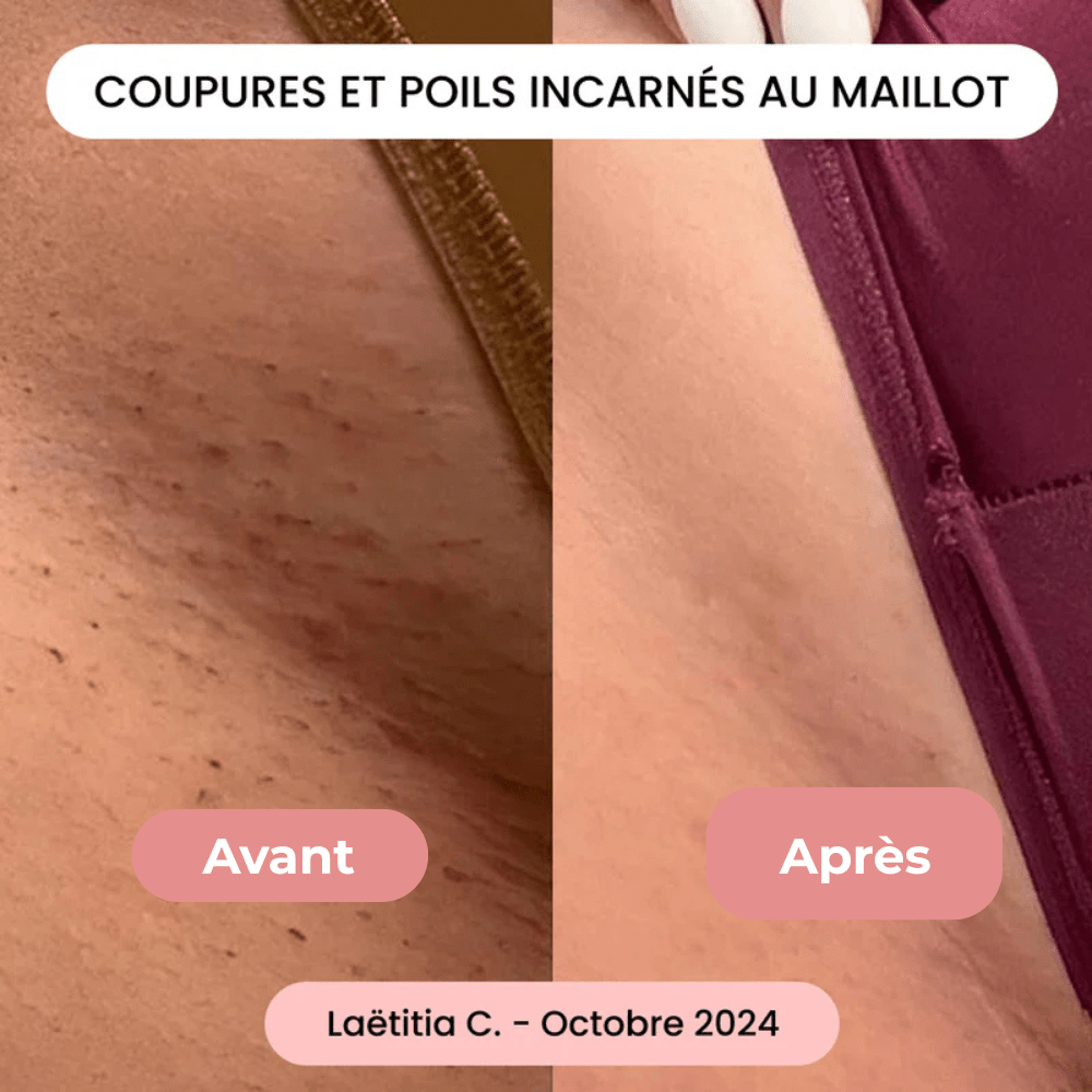 Rasoir Douceur - Tenava