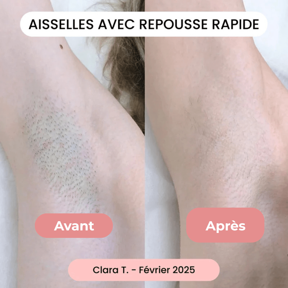 Rasoir Douceur - Tenava