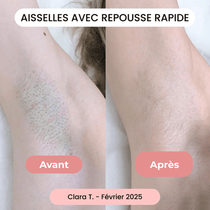 Rasoir Douceur - Tenava